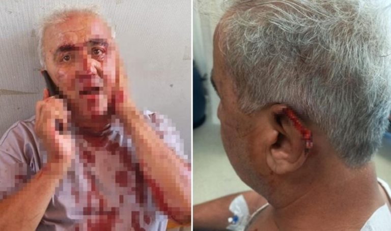 “Siktir git” kavgası dehşetle sona erdi: Yolcu, sürücünün kulağını ısırdı!  – Türkiye’den son dakika haberleri