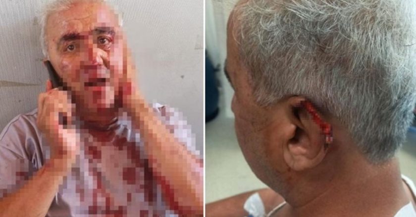 “Siktir git” kavgası dehşetle sona erdi: Yolcu, sürücünün kulağını ısırdı!  – Türkiye’den son dakika haberleri