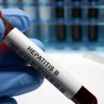 Hepatit B semptomları nelerdir? Hepatit B Nasıl Anlaşılır? Tedavi yöntemleri nelerdir?